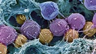Cabozantinibe é aprovado pelo FDA para tratamento de tumores neuroendócrinos pancreáticos e extra-pancreáticos